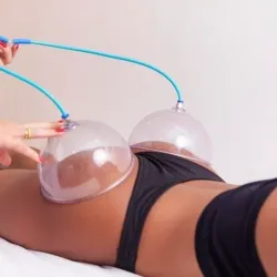 Vacumterapia para levantamiento de glúteos 