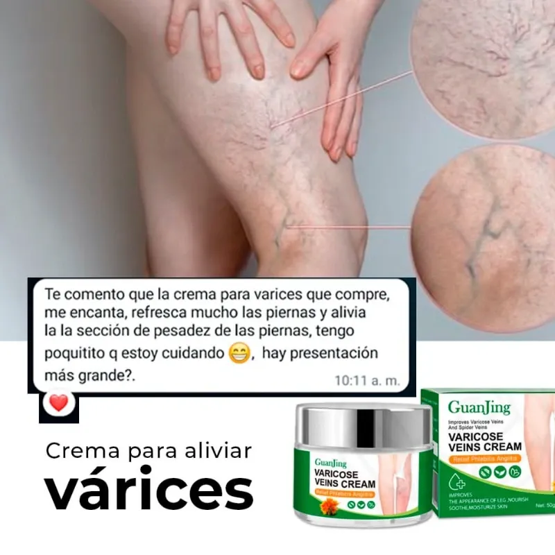 Crema para las varices