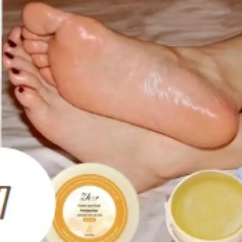 Crema antigrietas para pies y manos.