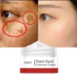 Crema facial aclaradora.