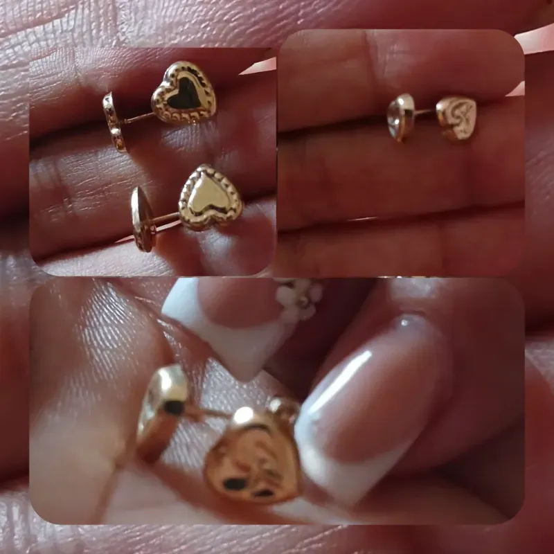 Aretes 