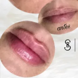 💋BBLIPS Hidratación de labios 