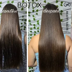 Botox