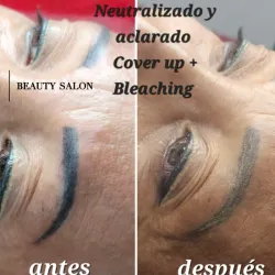 Cover up + Bleaching 