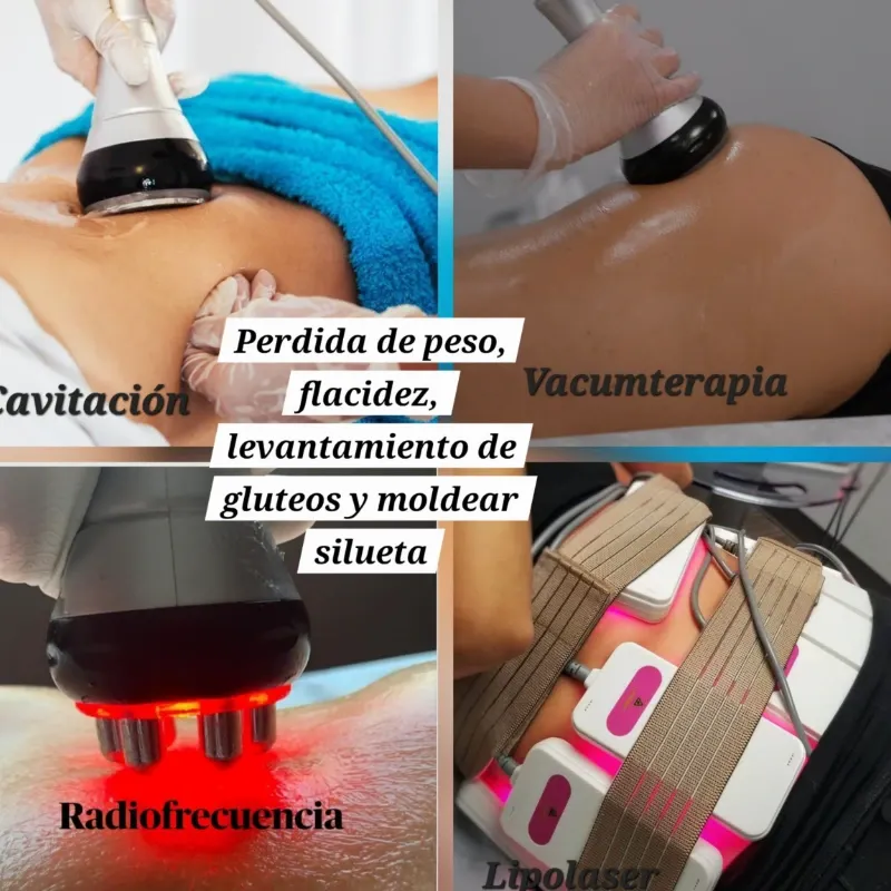 🍑 Definición de gluteos🍑 (sin copas)
