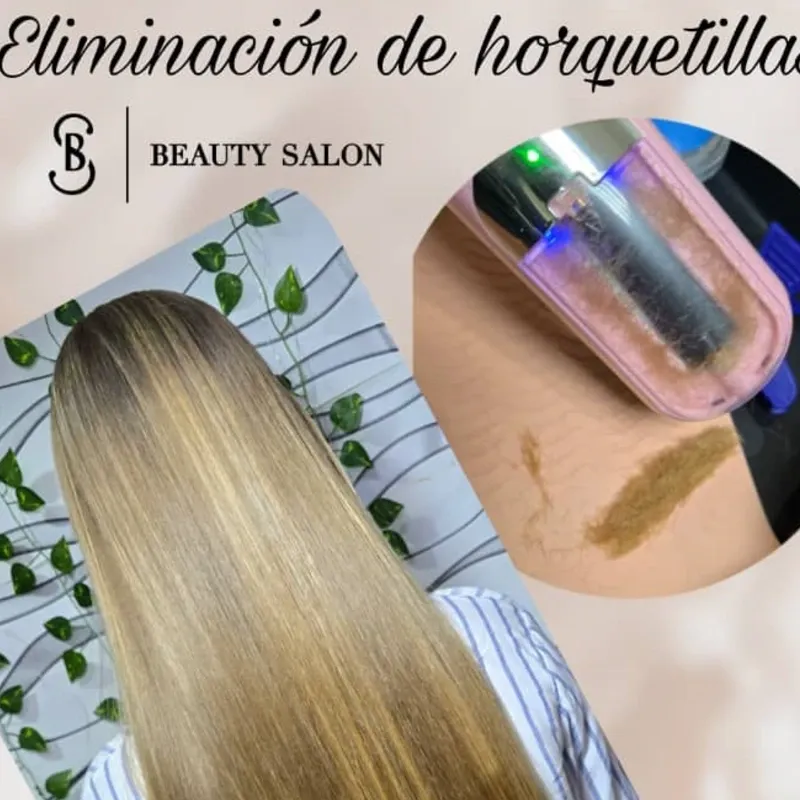 - Eliminación de Horquetillas -