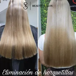 - Eliminación de Horquetillas -