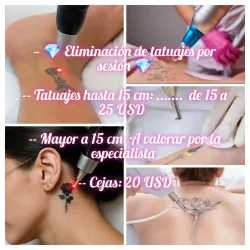 🔫 Eliminación de tatuajes con láser 