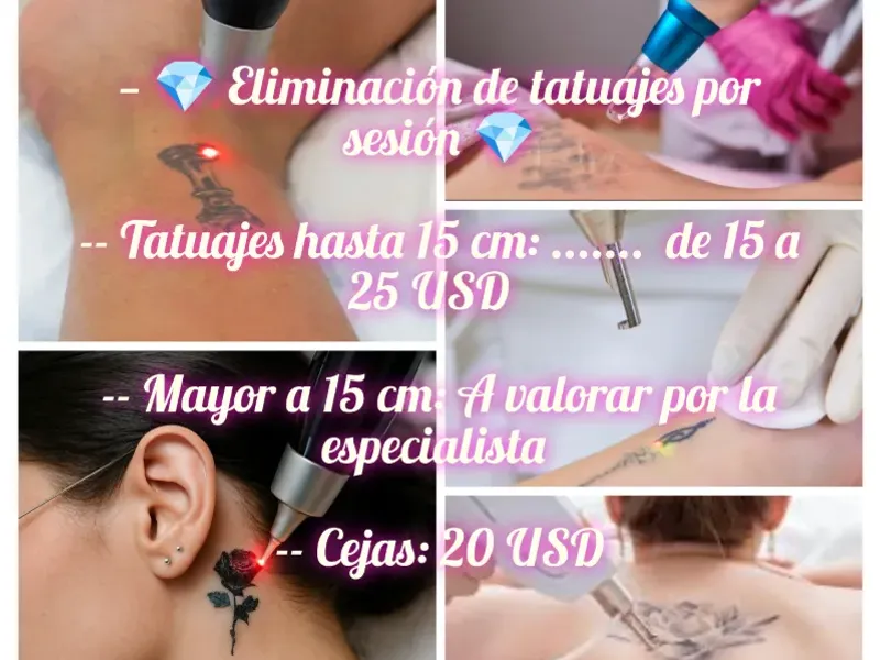 🔫Eliminación de tatuajes con láser 🔫