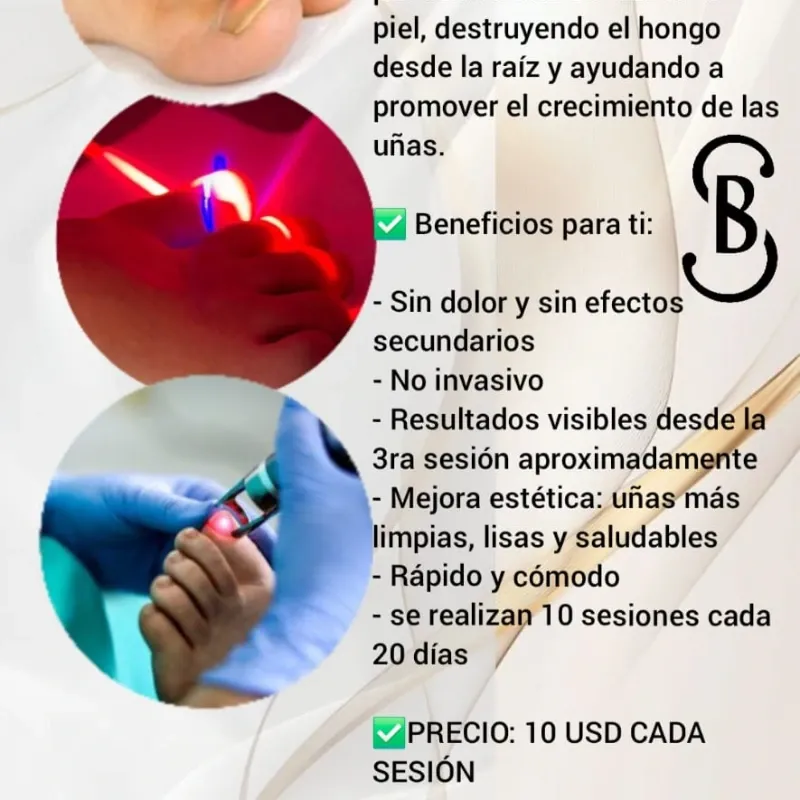 🔬Láser picosegundo para hongos en las uñas