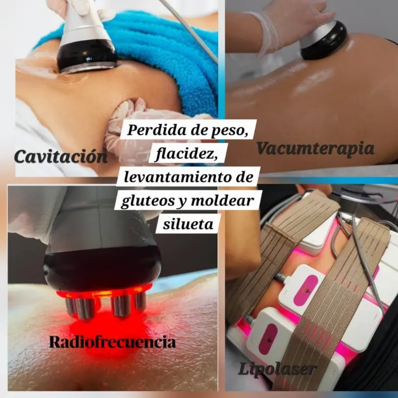 💝 Paquete completo "8 sesiones" 💝 Lipoescultura 35%😋 ✨