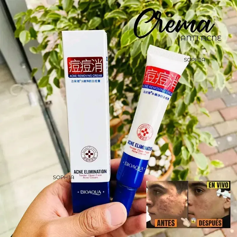 Crema facial antiacné