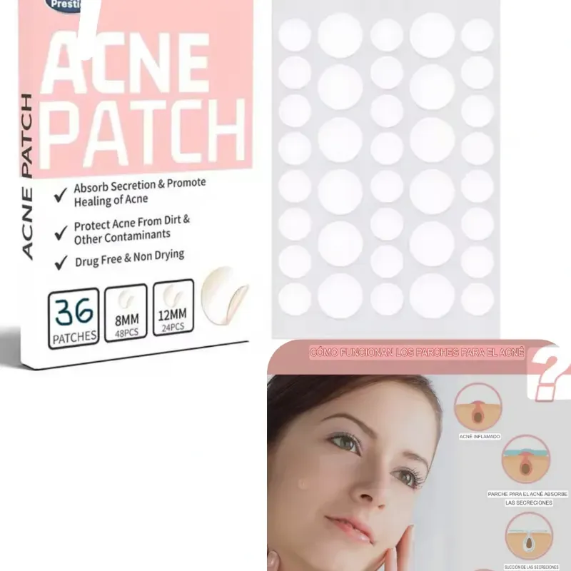 Parches para acné