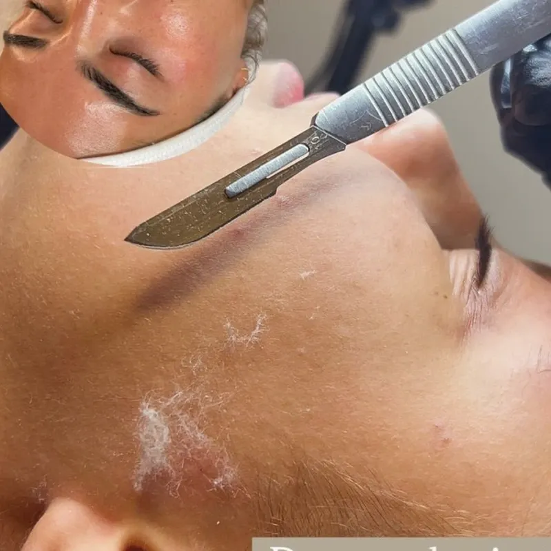 Limpieza facial con Dermaplaning