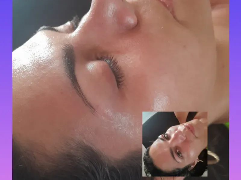 Tratamientos faciales 