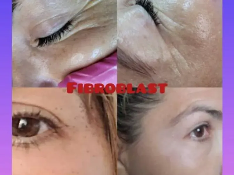 Tratamientos faciales regenerativos .