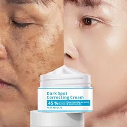 CHANCHI DARK SPOT CORRECTING CREAM