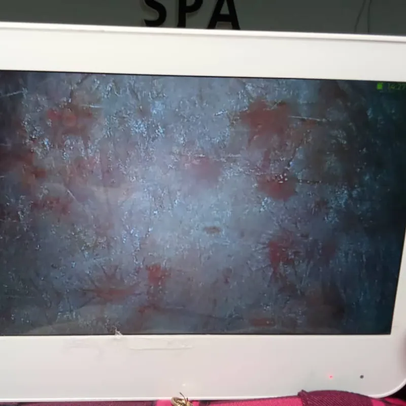 Análisis profundo cutáneo