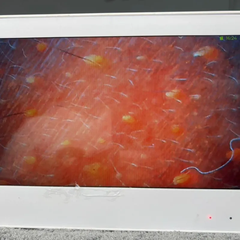 Análisis profundo cutáneo