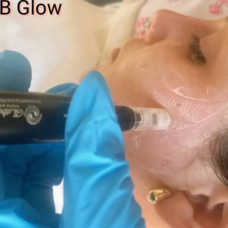 BBGLOW o piel de porcelana