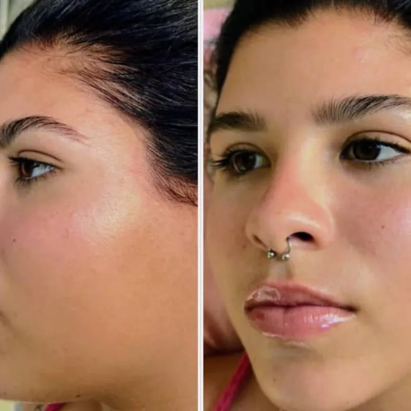 BBGLOW o piel de porcelana