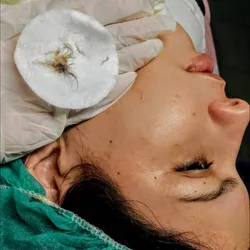 Dermaplaning Facial