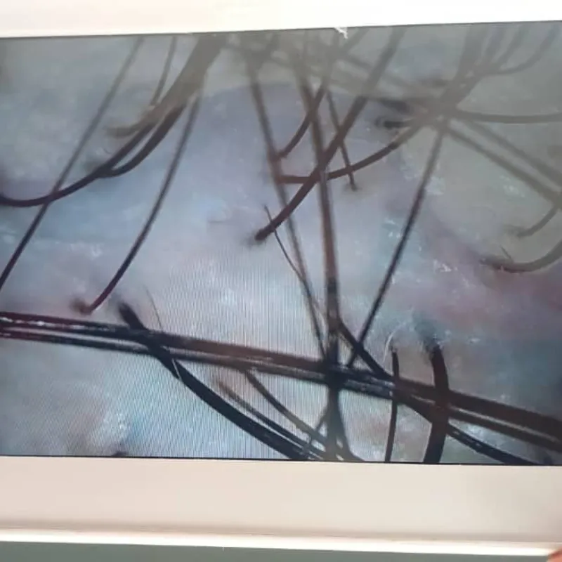 Diagnóstico Capilar