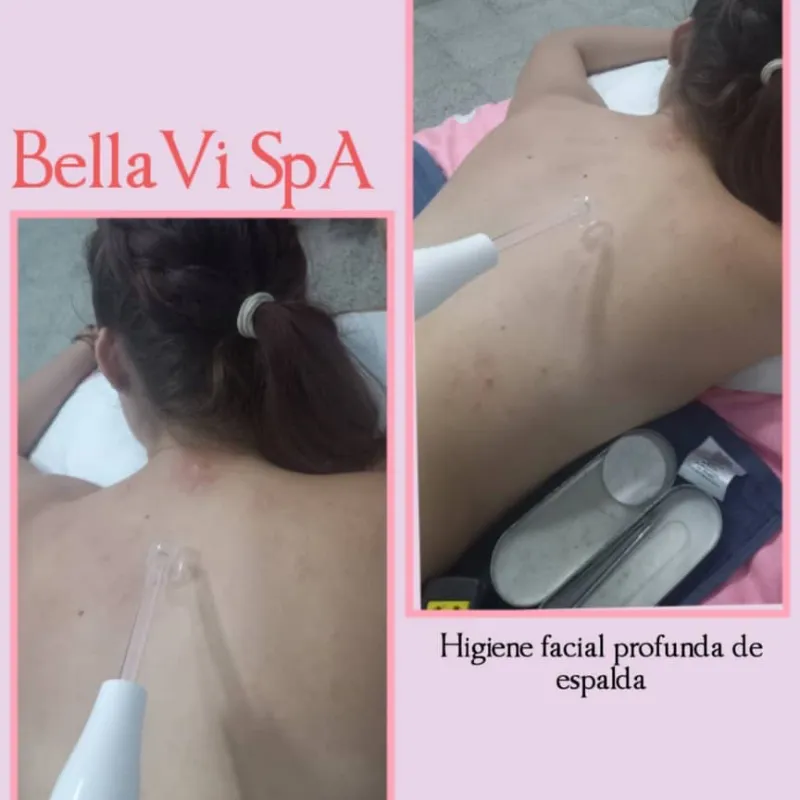 Limpieza de Espalda Profunda