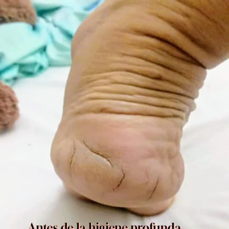 Limpieza Profunda Podal