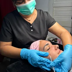 Mesoterapia facial