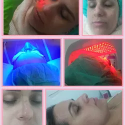 ⚡ Radiofrecuencia Facial