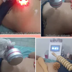 Tratamiento corporal completo