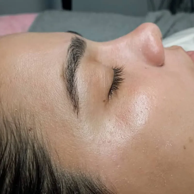 Tratamiento Hidratante 