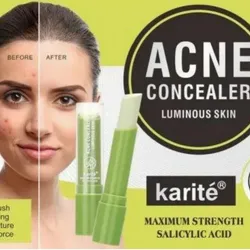 Corrector Anti Acné de Ácido Salicílico