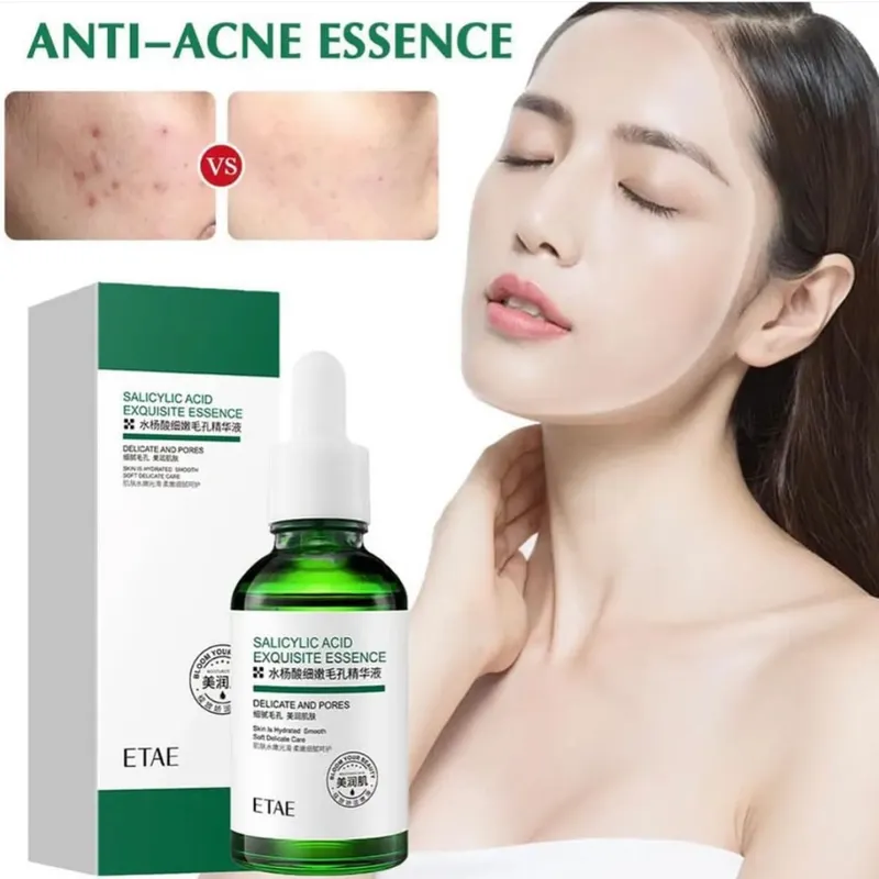 Serum Anti Acné Ácido Salicílico 