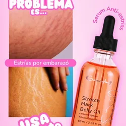 Serum Anti Estrias