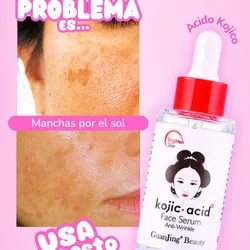 Serum de ácido Kojico