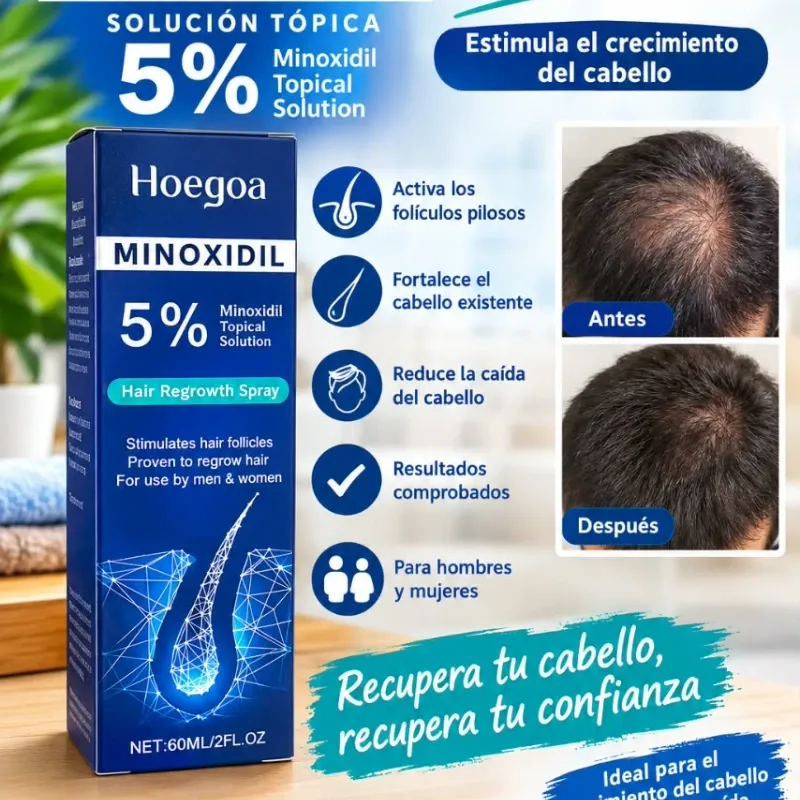Minoxidil 5% crecimiento del cabello