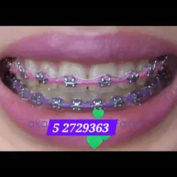 Cadenetas Moradas
