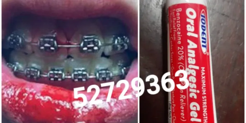 Combo de limpieza y cuidado dental