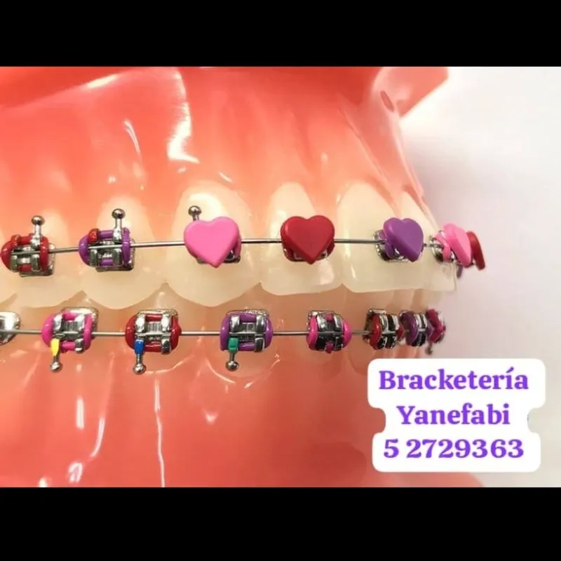 Elastómeros de corazones con función de cera de alivio para peladuras