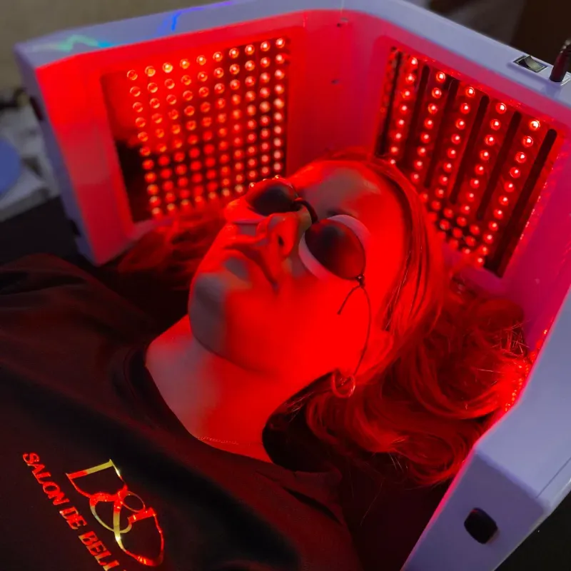 Biofotomodulación Capilar