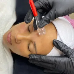 Limpieza FP con Vacum-terapia Facial