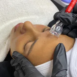 Vacum-terapia Facial 