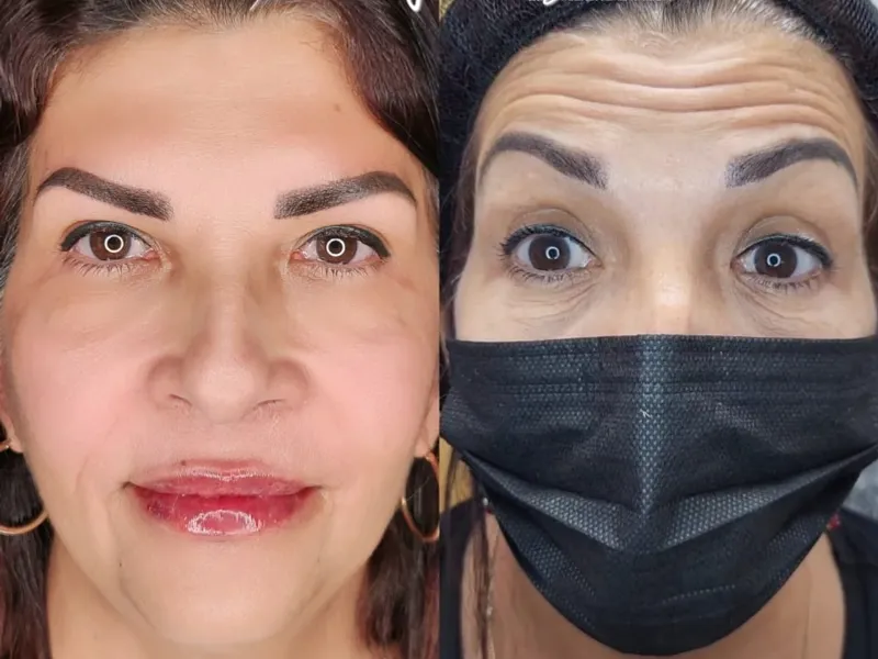 TRATAMIENTOS ANTIEDAD.