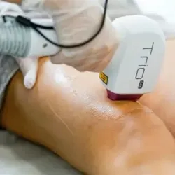 Depilacion Definitiva de Pierna Completa.