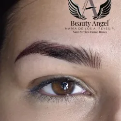 Retoque Antes de 3 Meses.