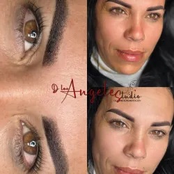 Retoque Después de 3 Meses.