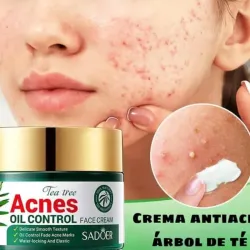 Crema facial de árbol de te Anti Acné  de SADOER 100ml