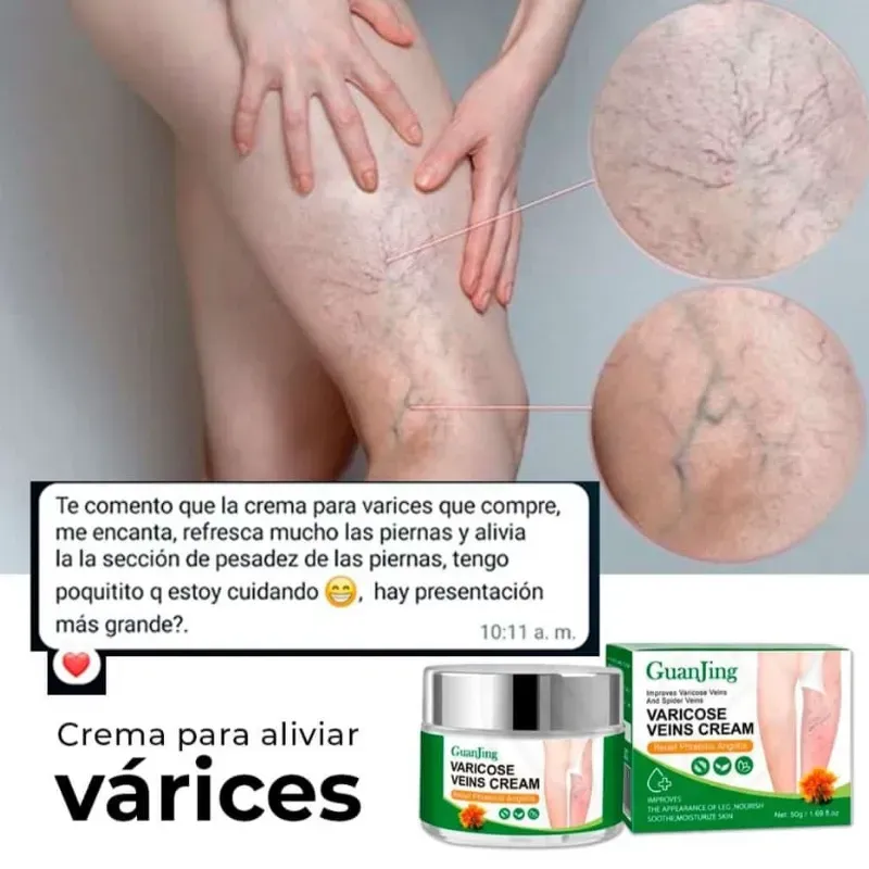 Crema para las varices 